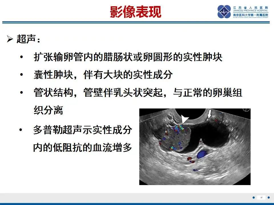 影像PPT - 【PPT】原发性输卵管癌-26