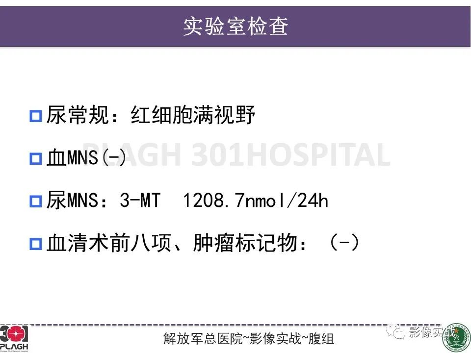 影像PPT - 【病例】节细胞神经母细胞瘤1例CT解析思路-3