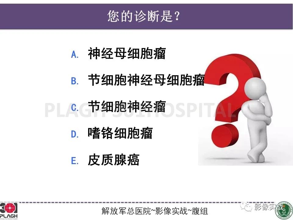 影像PPT - 【病例】节细胞神经母细胞瘤1例CT解析思路-16