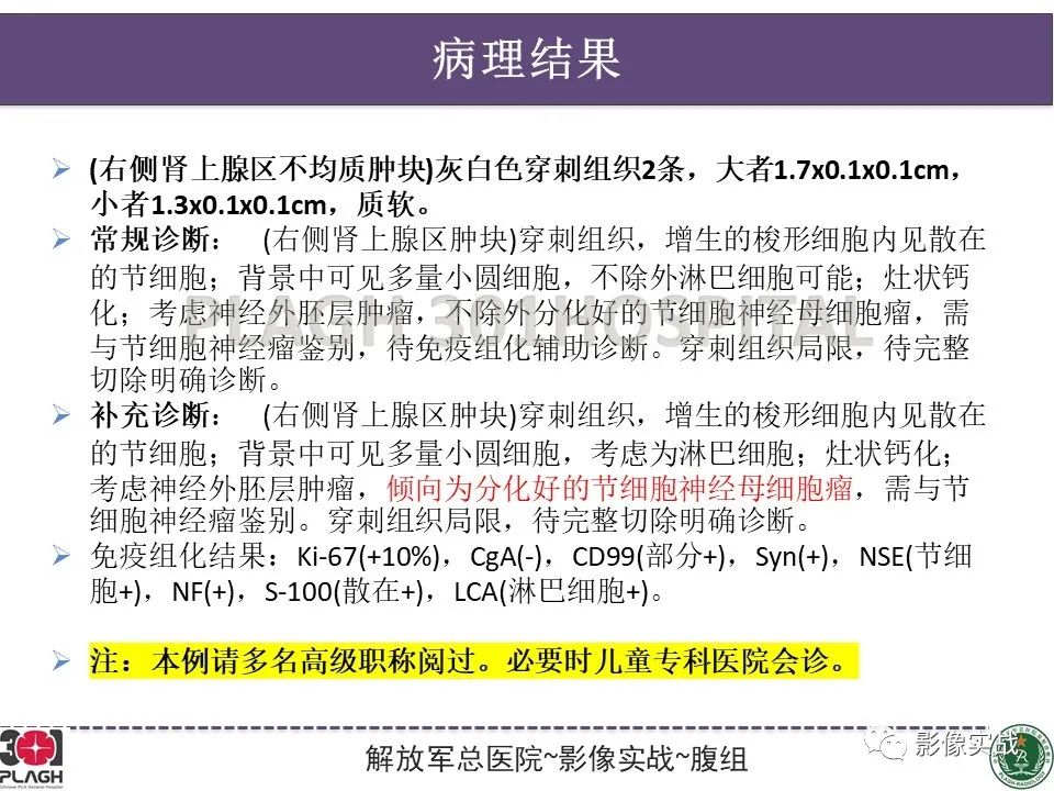 影像PPT - 【病例】节细胞神经母细胞瘤1例CT解析思路-29