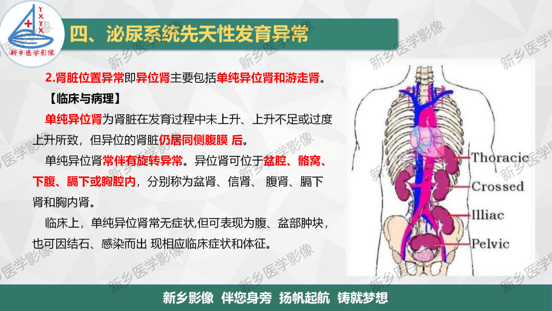 影像PPT - 【PPT】泌尿系统先天性发育异常影像表现-5