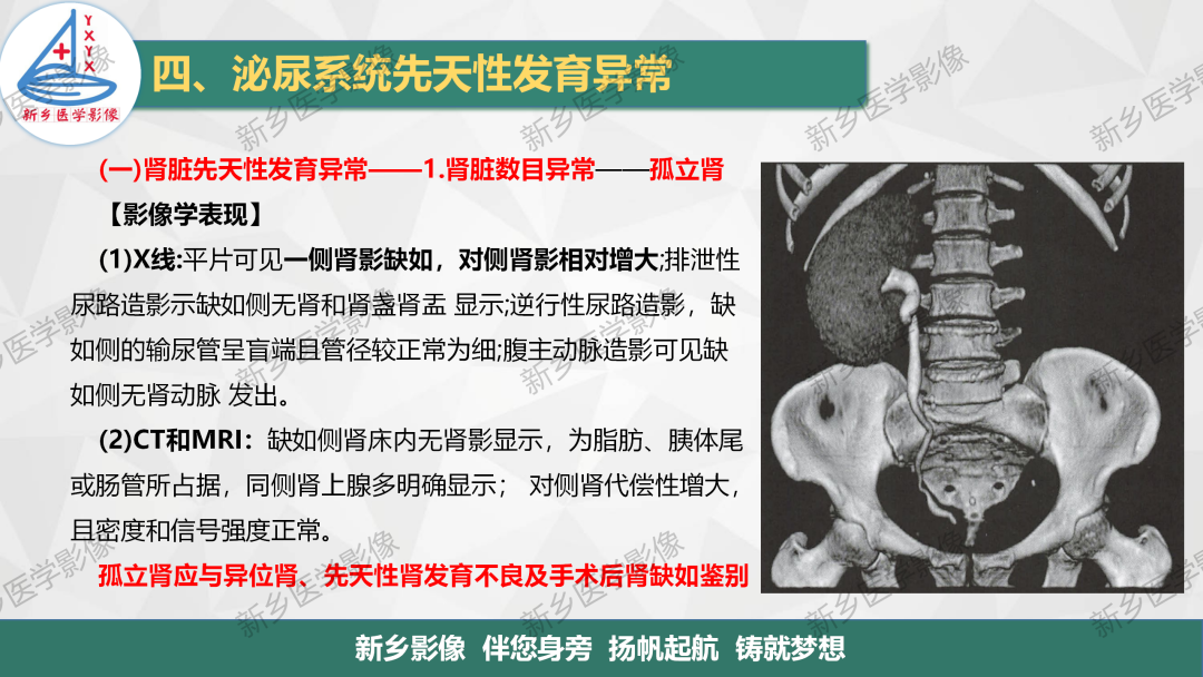 影像PPT - 【PPT】泌尿系统先天性发育异常影像表现-4