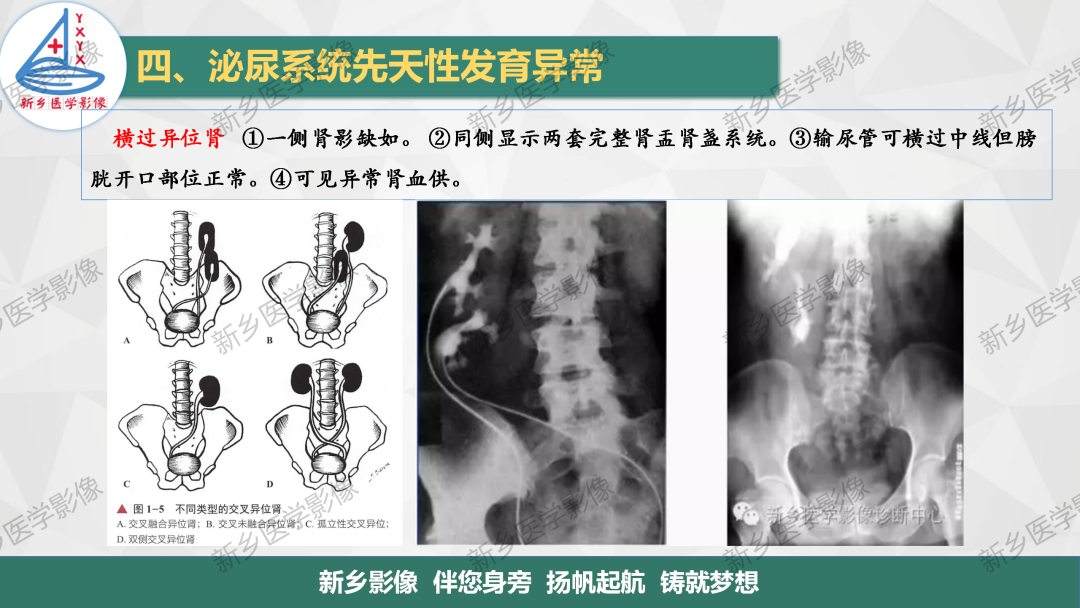 影像PPT - 【PPT】泌尿系统先天性发育异常影像表现-9