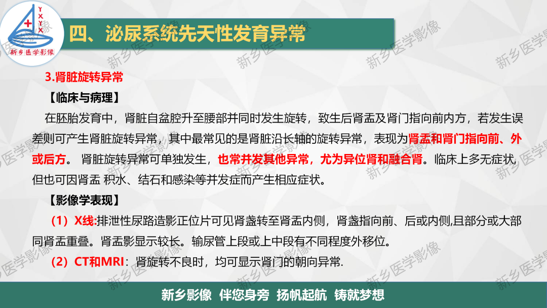 影像PPT - 【PPT】泌尿系统先天性发育异常影像表现-11