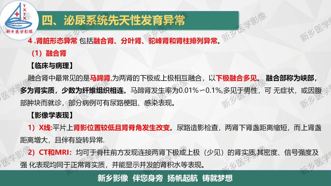影像PPT - 【PPT】泌尿系统先天性发育异常影像表现-16