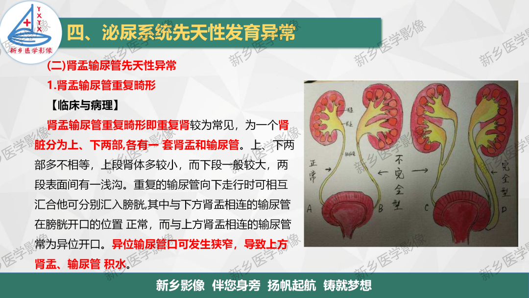 影像PPT - 【PPT】泌尿系统先天性发育异常影像表现-24