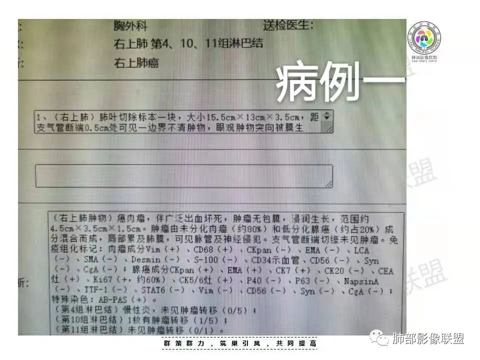 影像PPT - 【病例】肺肉瘤样癌1例CT-24 影像PPT - 【病例】肺肉瘤样癌1例CT-24