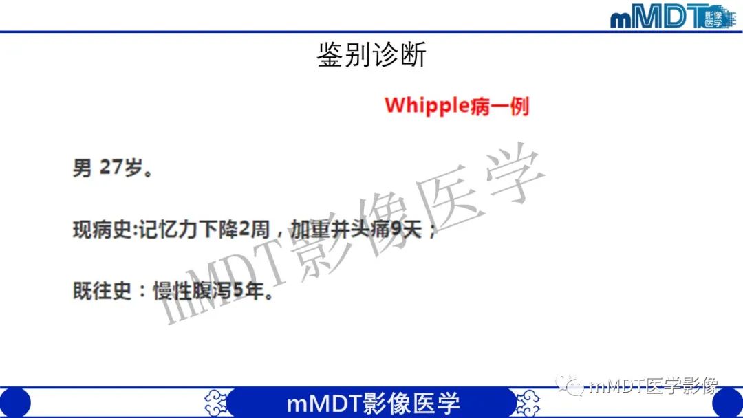 影像PPT - 【病例】铅中毒性脑病1例MR病例赏析-13 影像PPT - 【病例】铅中毒性脑病1例MR病例赏析-13