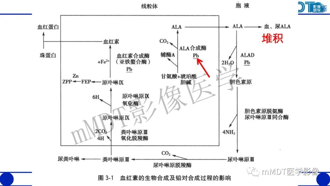 影像PPT - 【病例】铅中毒性脑病1例MR病例赏析-21 影像PPT - 【病例】铅中毒性脑病1例MR病例赏析-21