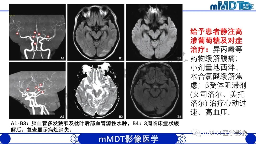 影像PPT - 【病例】铅中毒性脑病1例MR病例赏析-22 影像PPT - 【病例】铅中毒性脑病1例MR病例赏析-22