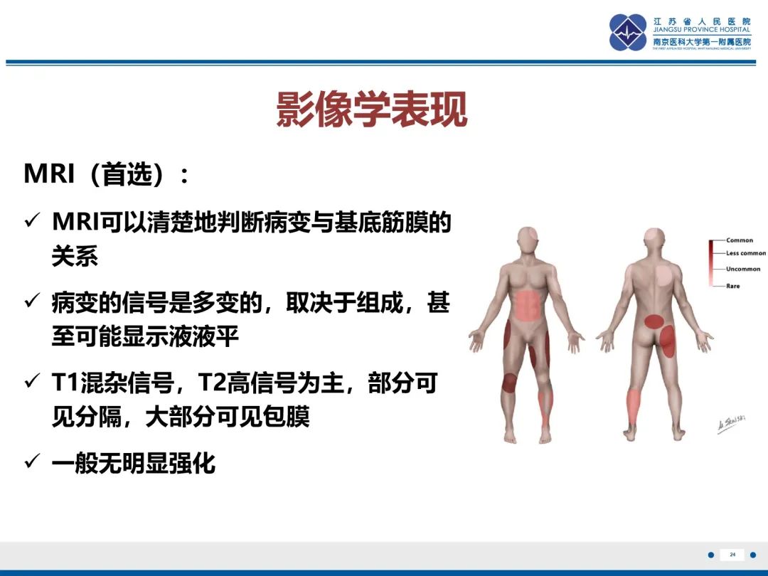 影像PPT - 【PPT】Morel-Lavallée 损伤​-25