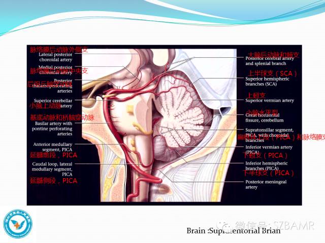 影像PPT - 【PPT】椎-基底动脉系统解剖-10 影像PPT - 【PPT】椎-基底动脉系统解剖-10
