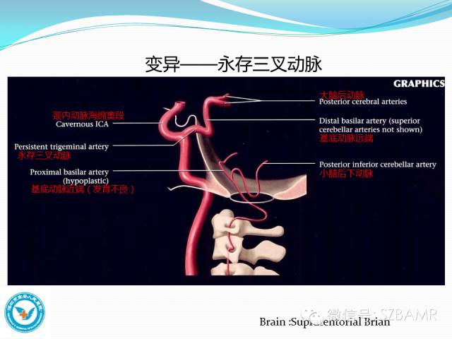 影像PPT - 【PPT】椎-基底动脉系统解剖-13 影像PPT - 【PPT】椎-基底动脉系统解剖-13