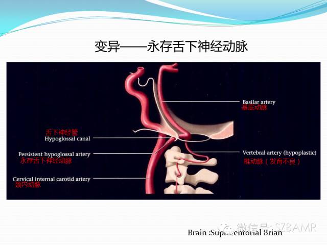 影像PPT - 【PPT】椎-基底动脉系统解剖-14 影像PPT - 【PPT】椎-基底动脉系统解剖-14