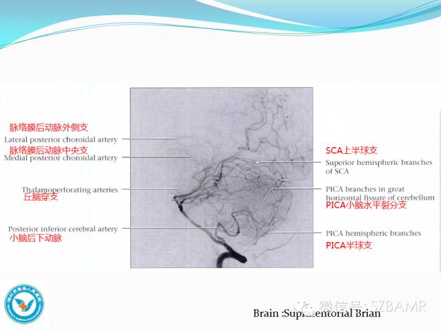 影像PPT - 【PPT】椎-基底动脉系统解剖-2 影像PPT - 【PPT】椎-基底动脉系统解剖-2