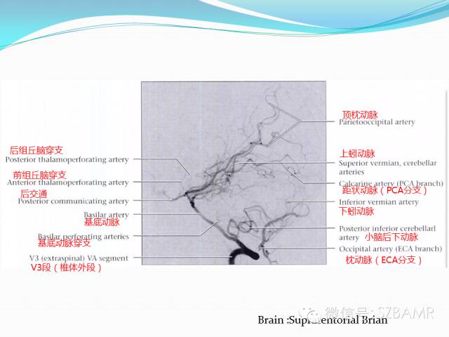 影像PPT - 【PPT】椎-基底动脉系统解剖-1 影像PPT - 【PPT】椎-基底动脉系统解剖-1