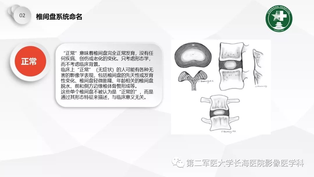 影像PPT - 【PPT】椎间盘退行性病变诊疗-12