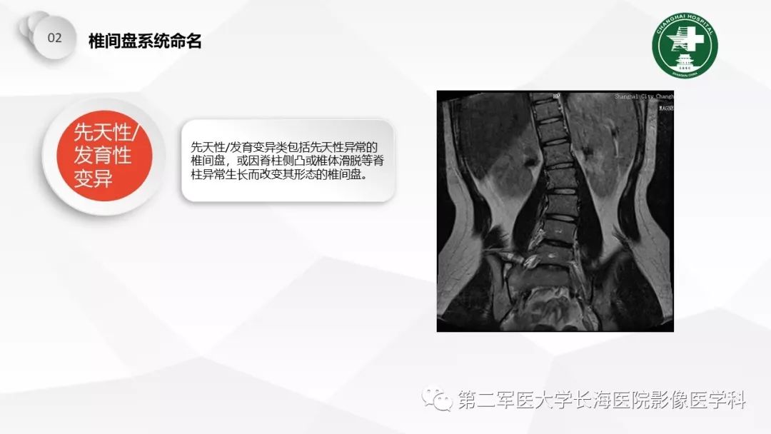 影像PPT - 【PPT】椎间盘退行性病变诊疗-13