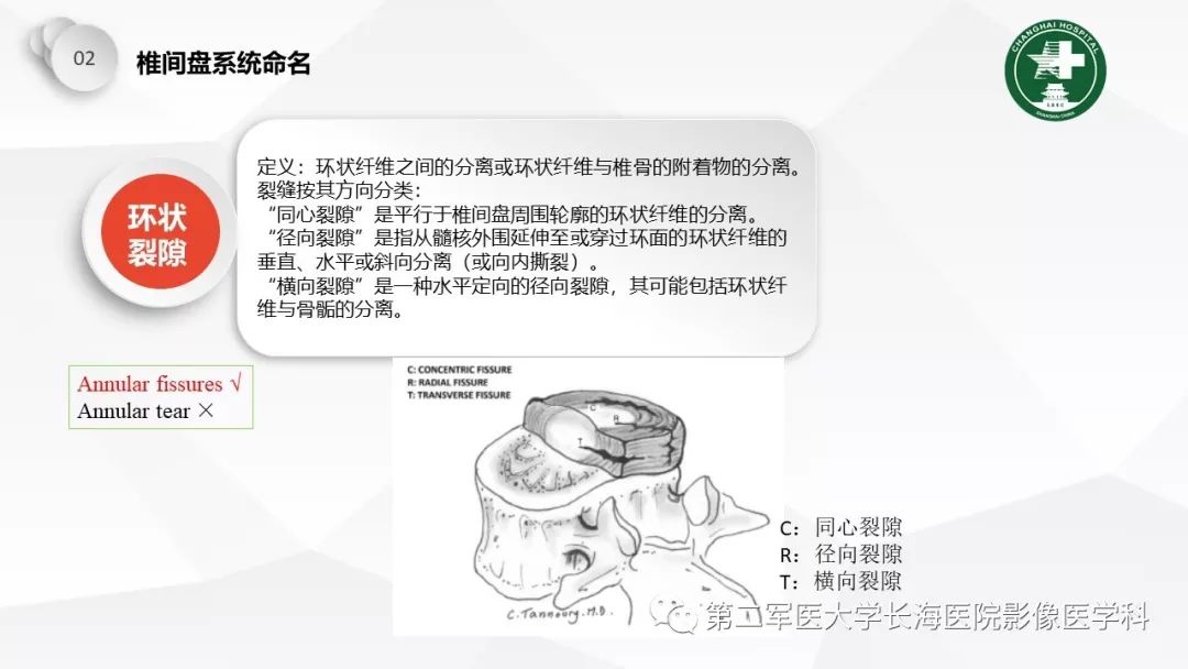 影像PPT - 【PPT】椎间盘退行性病变诊疗-15