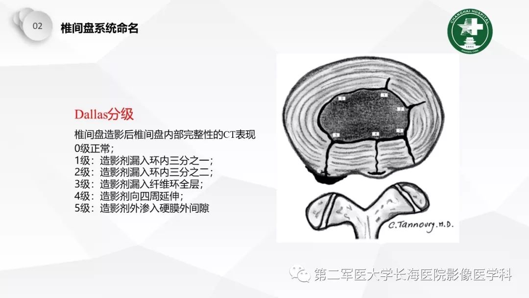影像PPT - 【PPT】椎间盘退行性病变诊疗-18