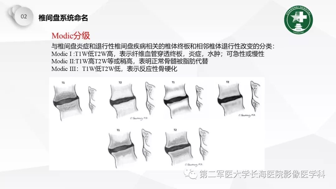 影像PPT - 【PPT】椎间盘退行性病变诊疗-19