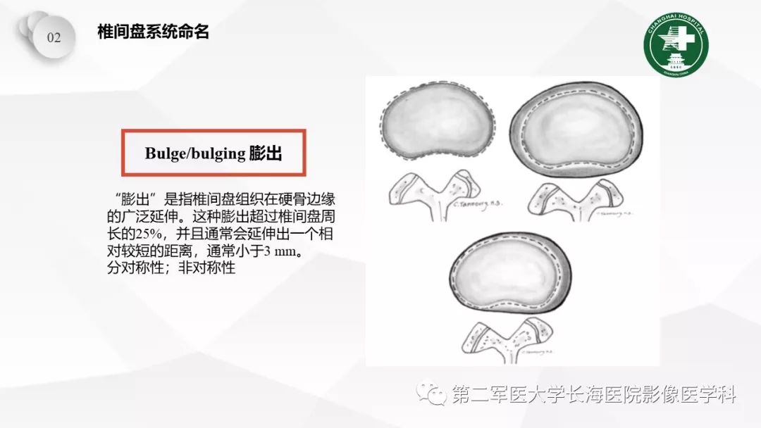影像PPT - 【PPT】椎间盘退行性病变诊疗-24