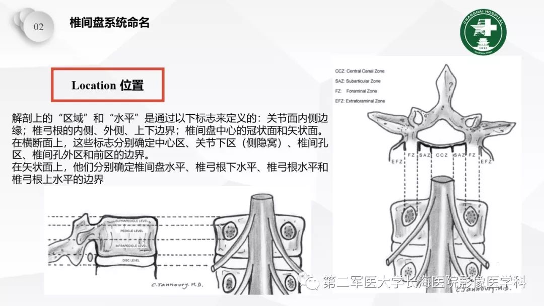 影像PPT - 【PPT】椎间盘退行性病变诊疗-25