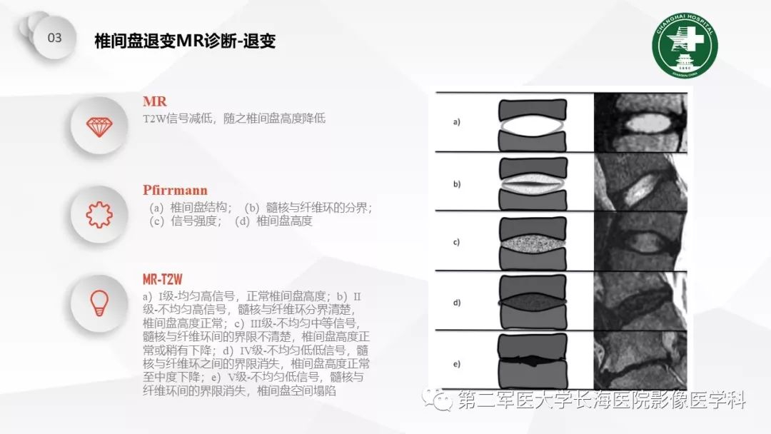影像PPT - 【PPT】椎间盘退行性病变诊疗-33