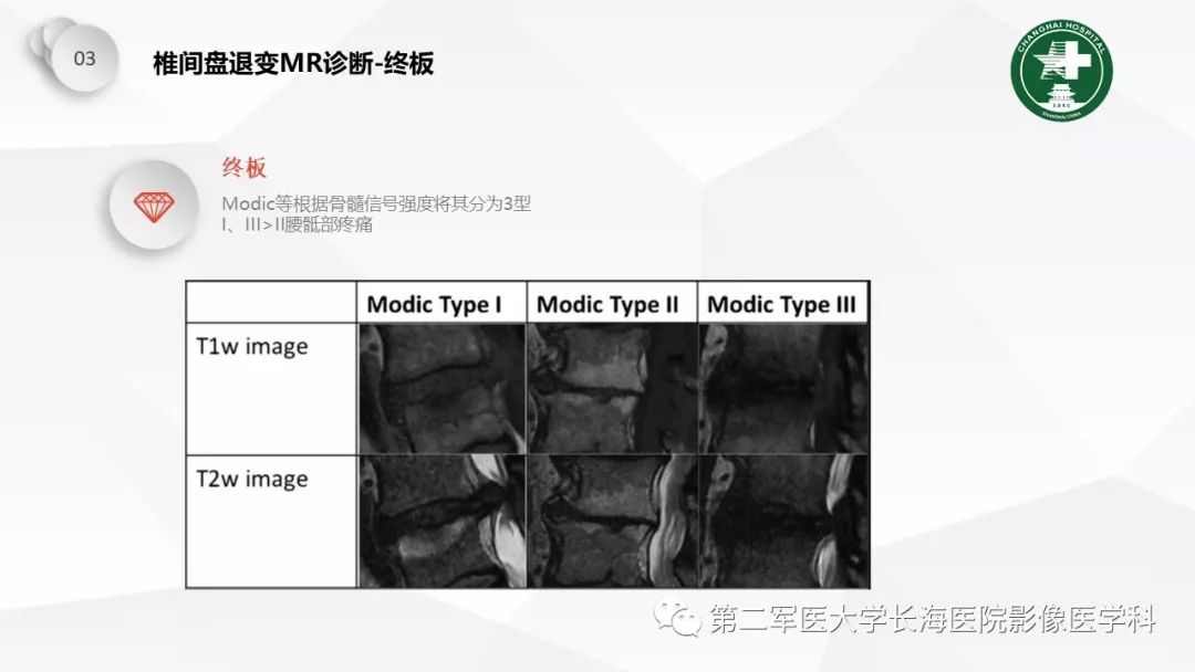影像PPT - 【PPT】椎间盘退行性病变诊疗-34