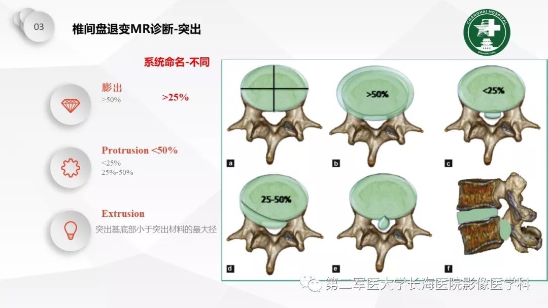影像PPT - 【PPT】椎间盘退行性病变诊疗-38