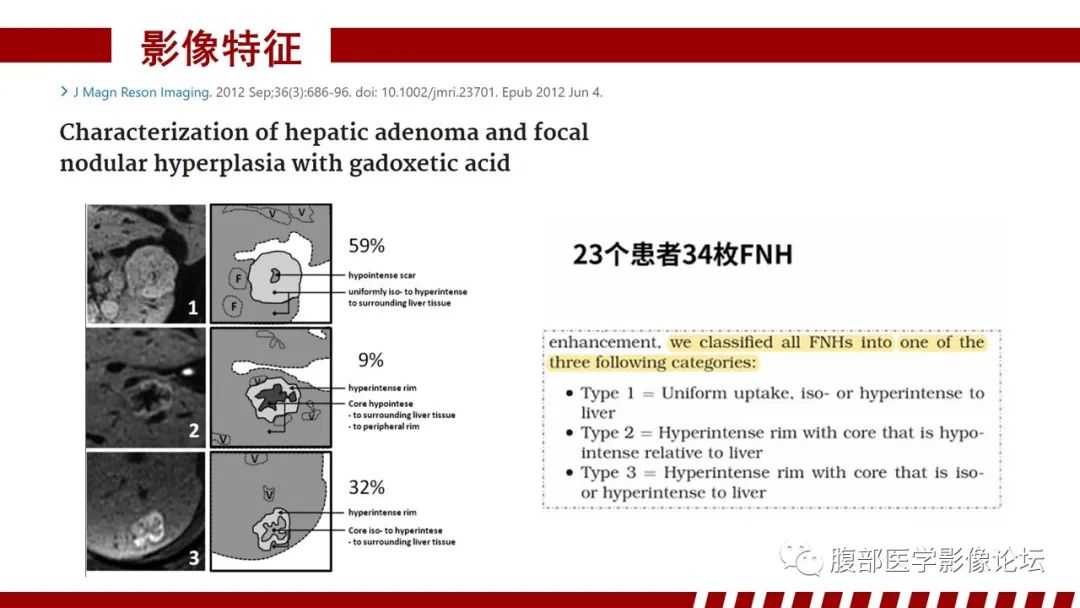 影像PPT - 【PPT】肝胆期高信号的病变影像表现及临床意义-19
