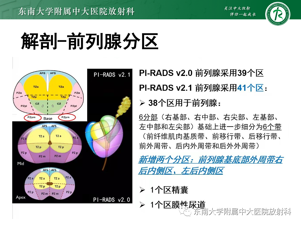 影像PPT - 【PPT】前列腺脓肿-6 影像PPT - 【PPT】前列腺脓肿-6