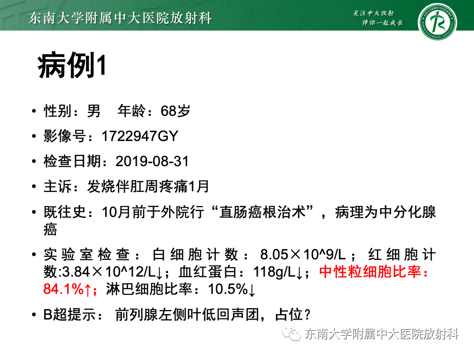 影像PPT - 【PPT】前列腺脓肿-2 影像PPT - 【PPT】前列腺脓肿-2
