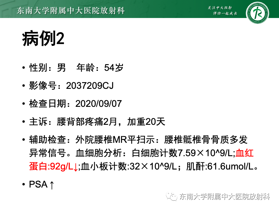 影像PPT - 【PPT】前列腺脓肿-20 影像PPT - 【PPT】前列腺脓肿-20