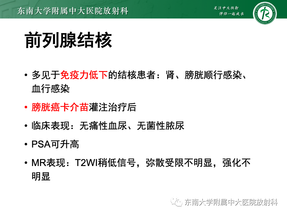 影像PPT - 【PPT】前列腺脓肿-40 影像PPT - 【PPT】前列腺脓肿-40