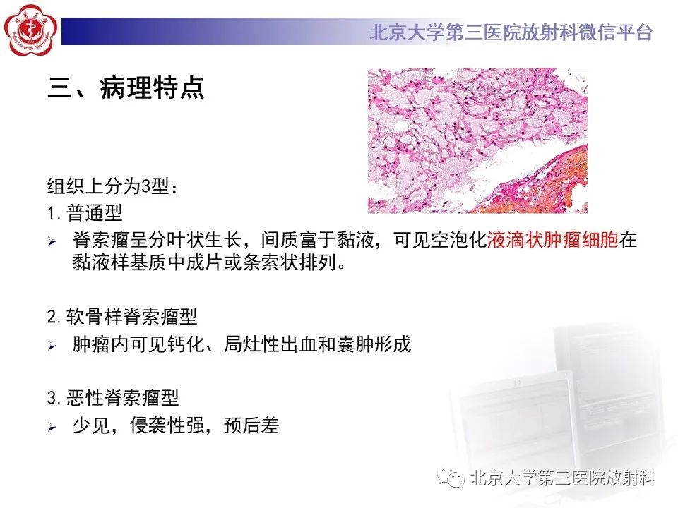 影像PPT - 【PPT】骶尾部原发性脊索瘤-12