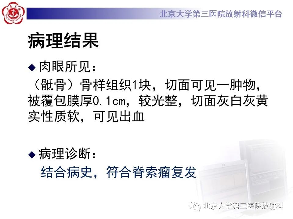 影像PPT - 【PPT】骶尾部原发性脊索瘤-8