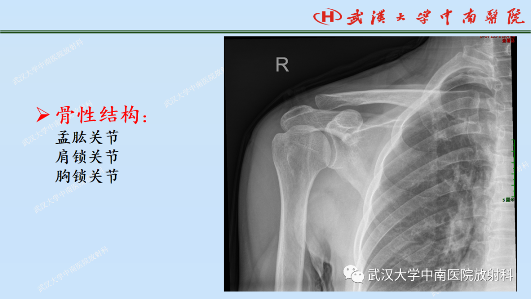 影像PPT - 【PPT】肩关节的MR影像解剖及其慢性损伤-2