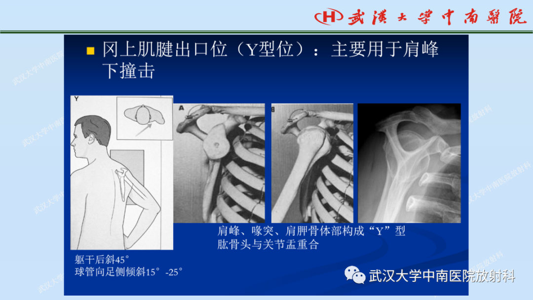 影像PPT - 【PPT】肩关节的MR影像解剖及其慢性损伤-10