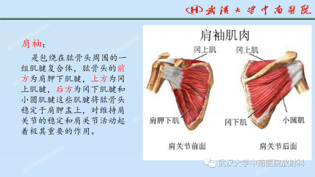 影像PPT - 【PPT】肩关节的MR影像解剖及其慢性损伤-16