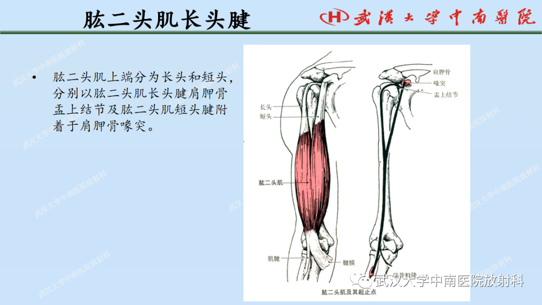 影像PPT - 【PPT】肩关节的MR影像解剖及其慢性损伤-22