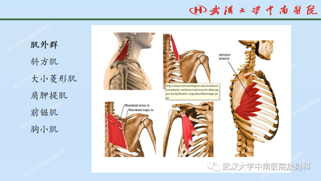 影像PPT - 【PPT】肩关节的MR影像解剖及其慢性损伤-21
