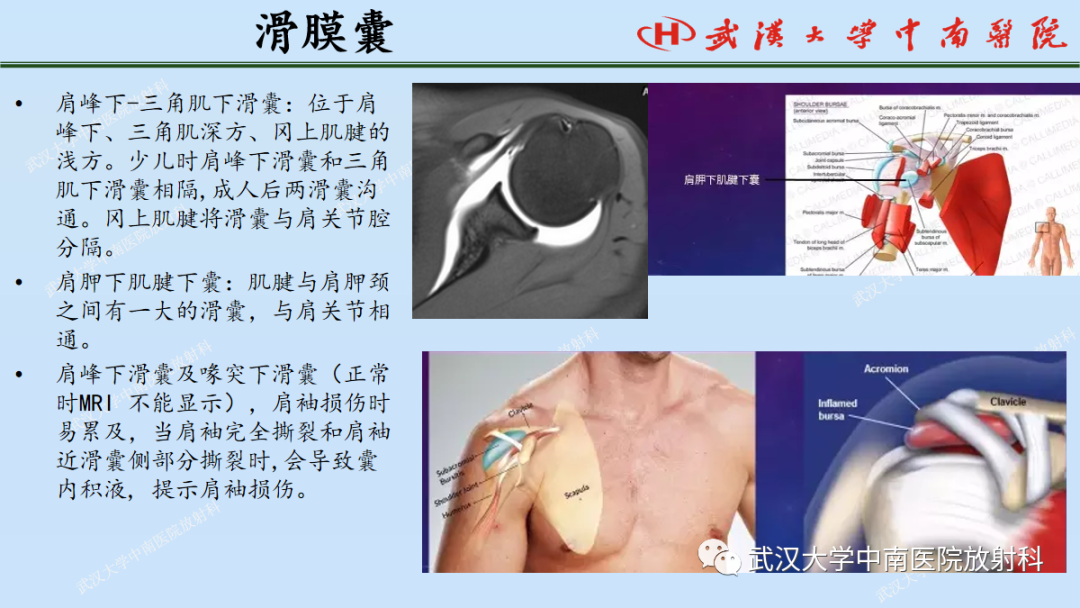 影像PPT - 【PPT】肩关节的MR影像解剖及其慢性损伤-31