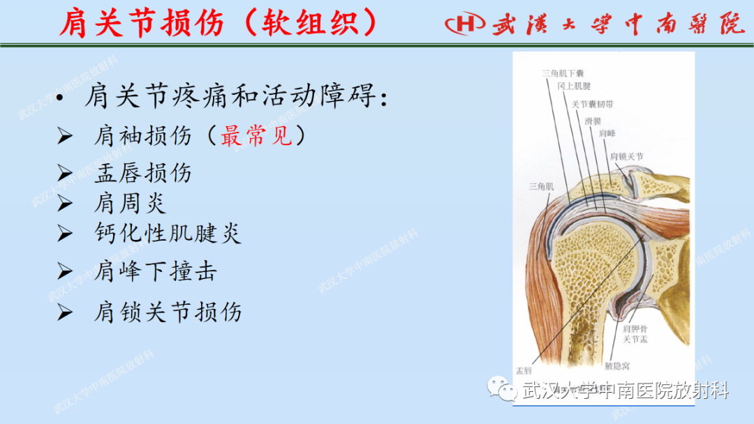 影像PPT - 【PPT】肩关节的MR影像解剖及其慢性损伤-36