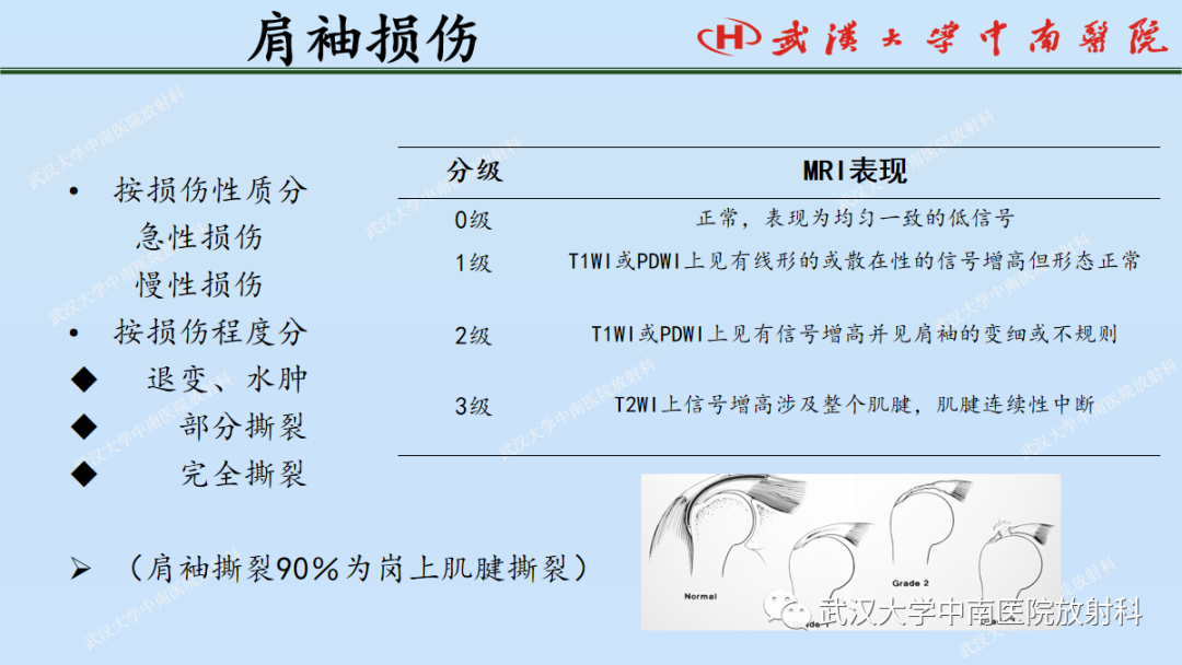 影像PPT - 【PPT】肩关节的MR影像解剖及其慢性损伤-37
