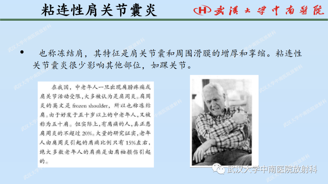 影像PPT - 【PPT】肩关节的MR影像解剖及其慢性损伤-45