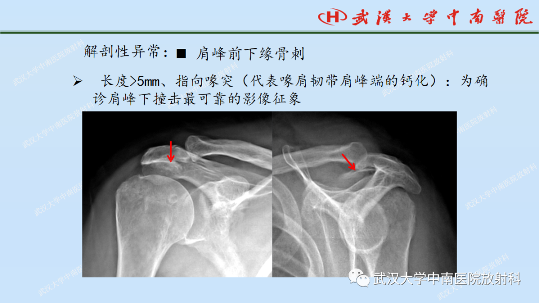 影像PPT - 【PPT】肩关节的MR影像解剖及其慢性损伤-51