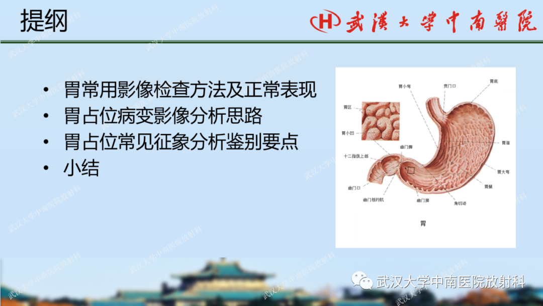 影像PPT - 【PPT】胃占位病变影像诊断分析-2