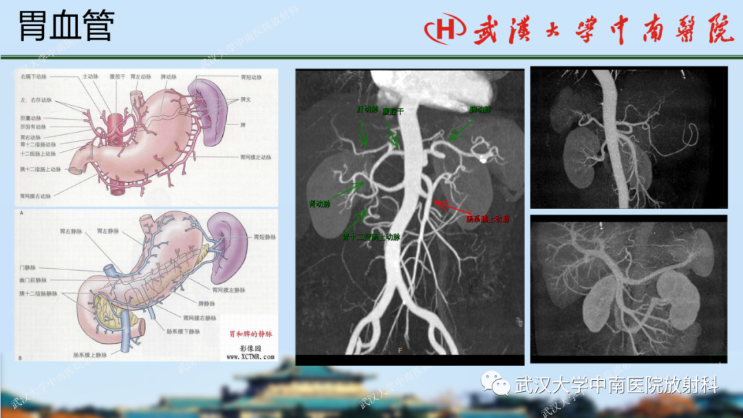 影像PPT - 【PPT】胃占位病变影像诊断分析-7