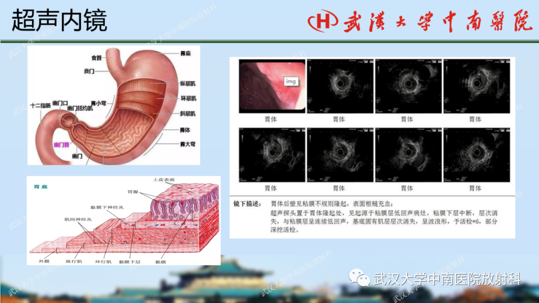 影像PPT - 【PPT】胃占位病变影像诊断分析-13
